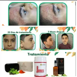 COMBO - DETOX FACIL JUFRES + JABON FACIL